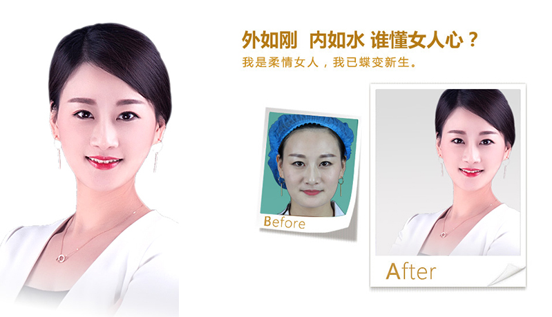 永川V脸、线雕隆鼻